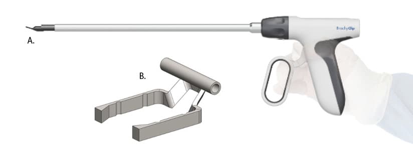 BrachyClip handheld applicator with clip detail showing seed insertion